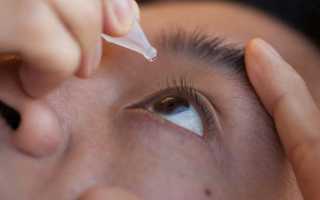 ТОП 10 глазных капель при близорукости