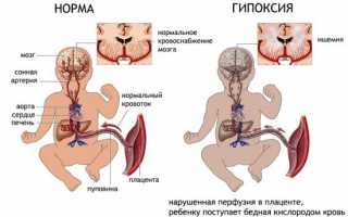 Оценка функционального состояния женщины и плода на 3 скрининге