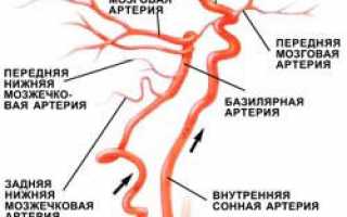 Диагностика кровообращения на УЗИ сосудов головы и шеи