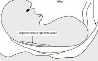 Нормы биохимического скрининга 1 триместра беременности