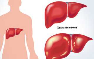 На что указывает HCV и Anti-HCV в анализе крови?