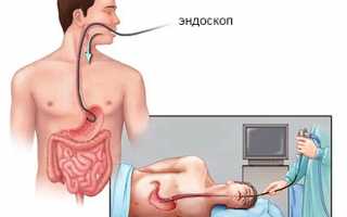 Точное исследование состояния желудка на гастроскопии
