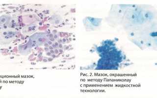 Когда и зачем применяется цитологическое исследование мазка?