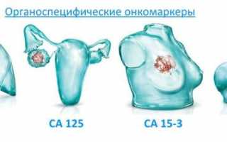 Значение СА-125 в анализе крови