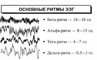 ЭЭГ при обследовании головного мозга: что показывает