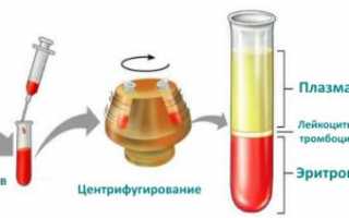 Отклонения от нормы гематокрита у детей и взрослых