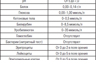 Причины плохого анализа мочи