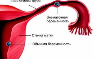 Срок, на котором УЗИ показывает беременность