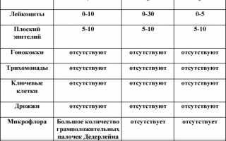 Расшифровка результатов мазка на степень чистоты