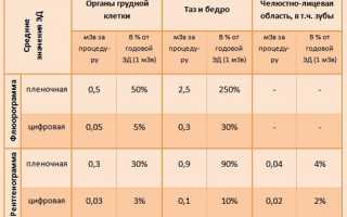 Вредна ли флюорография при беременности?