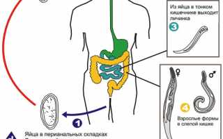 Достоверный способ диагностики — мазок на энтеробиоз