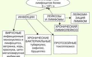 Об относительном и абсолютном лимфоцитозе — что это такое?