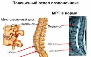 Что покажет МРТ поясничного отдела?