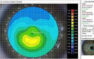 Современная диагностика роговицы методом кератометрии