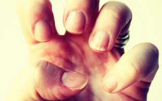Почему болят ногти?