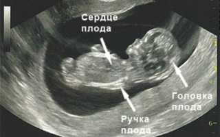 Определение изменений по фото размера плода на УЗИ на 9 неделе беременности