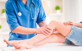Лечение варикоза на ногах: как лечить варикозное расширение вен