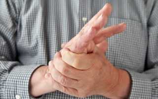 Немеют руки: причины и методы лечения