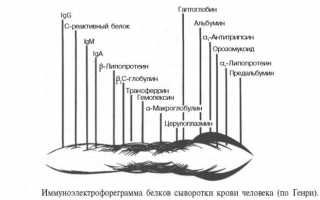 Биохимический анализ фракций белков крови