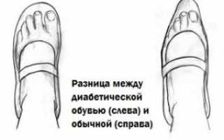 Характеристики ортопедической обуви для диабетиков