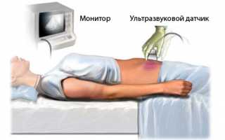 Как подготовиться к УЗИ брюшной полости?