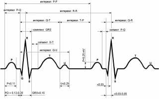 Секреты расшифровки ЭКГ