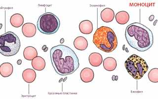 Когда моноциты повышены — что это значит?