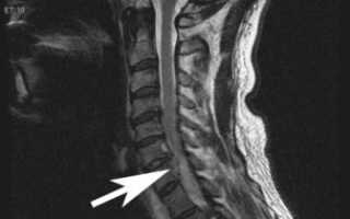 Современная процедура МРТ спины