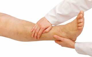 Отек ног ниже колена: причины и методы лечения