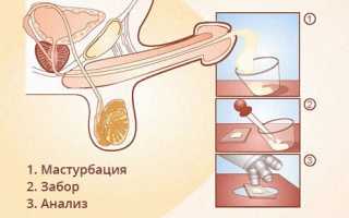 Показатели нормы для спермограммы