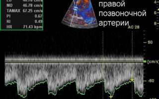 Как делают УЗИ головного мозга?