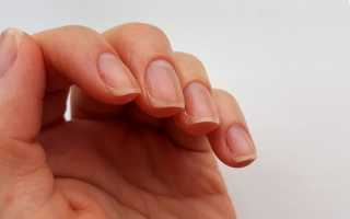 30 способов восстановить ногти после грибка