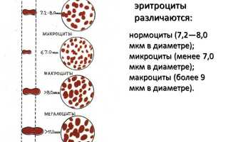 Патологическое изменение кровяных телец — анизоцитоз эритроцитов