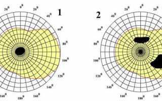 Диагностика скотомы и причин ее появления