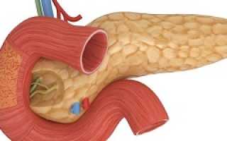 Последствия удаления поджелудочной железы