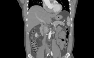 Диагностика организма методом компьютерной томографии