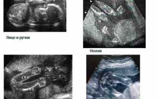 Развитие ребенка, видимое на УЗИ к 24 неделе беременности