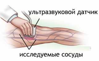 Показания для проведения УЗИ нижних конечностей