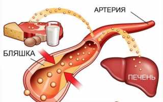 Хорошо ли когда коэффициент атерогенности понижен?