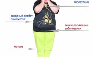 Причины метаболического синдрома и способы его лечения