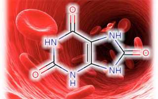 Почему понижена мочевая кислота в крови?