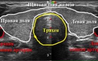 Признаки заболевания на УЗИ щитовидной железы