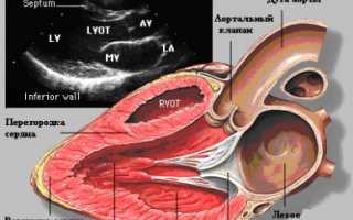 Некоторые данные расшифровки результатов УЗИ сердца