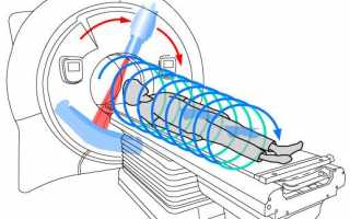 Чем отличается мультиспиральная компьютерная томография от обычной КТ?